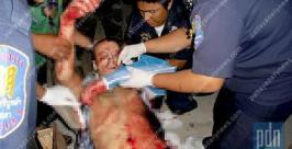Российского туриста ограбили и изрезали ножом до полусмерти в Таиланде Pattaya daily news